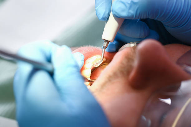 Best Root Canal Emergency Dentist  in Mcnary, AZ