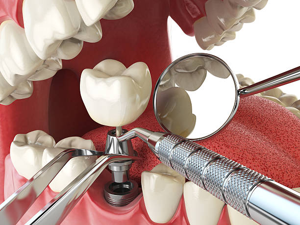 Best Urgent Tooth Repair  in Mcnary, AZ